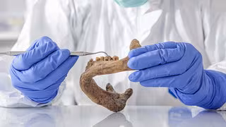 Im Bakterien-Steinzeit-Zoo für die Medizin der Zukunft