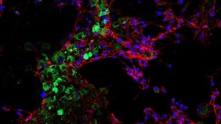 Nanoplastik in Tierzellen nachgewiesen. Was macht das mit unserer Ernährung?