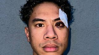 Comedian Tutty Tran geschlagen und beleidigt