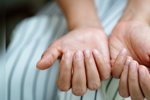 So stärkt man brüchige Nägel langfristig