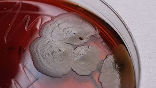 Wie Bakterien resistent gegen Antibiotika werden und was dagegen hilft